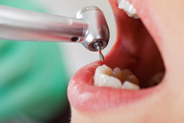 Best Emergency Treatment for Toothache in Tahoka, TX